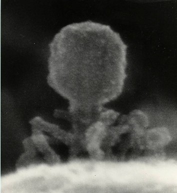 Observation of T2-bacteriophages, Prof. K. Tanaka (Tottori University), 1988, Equipment: in-lens type FE-SEM