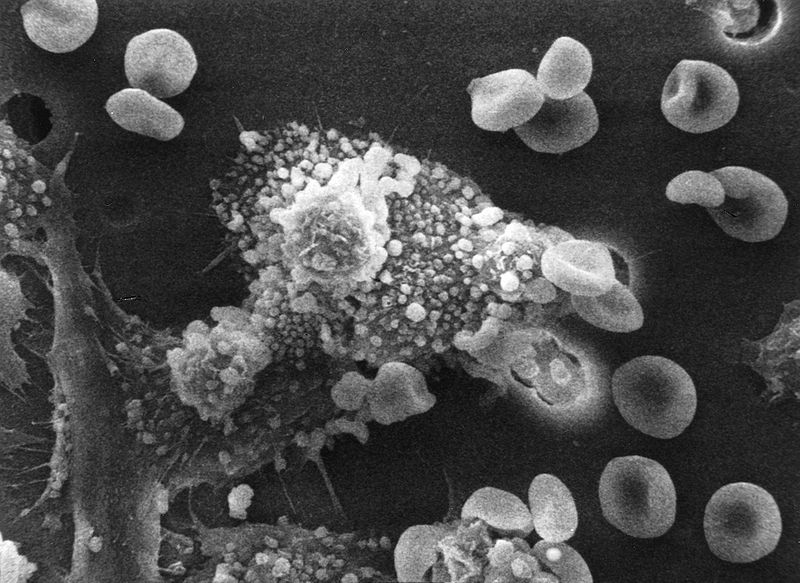 File:Biological Effects of Radiation Killing of Cancer Cells Attribution.jpg